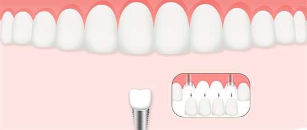 濟南口腔醫(yī)學專業(yè)學校是什么層次的學校？學校怎么樣？